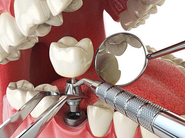 Best Emergency Root Canal Treatment in South Woodstock, CT